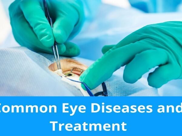 Cost of Common Eye Treatments in Chennai: LASIK, Cataract & More